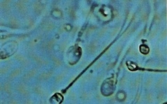 spermatozoaria