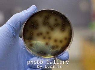 e-coli1