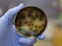 e-coli1