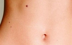 koilia-melanoma