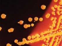 Enterobacteriaceae